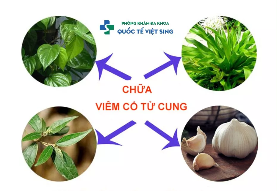 Cách chữa viêm lộ tuyến cổ tử cung