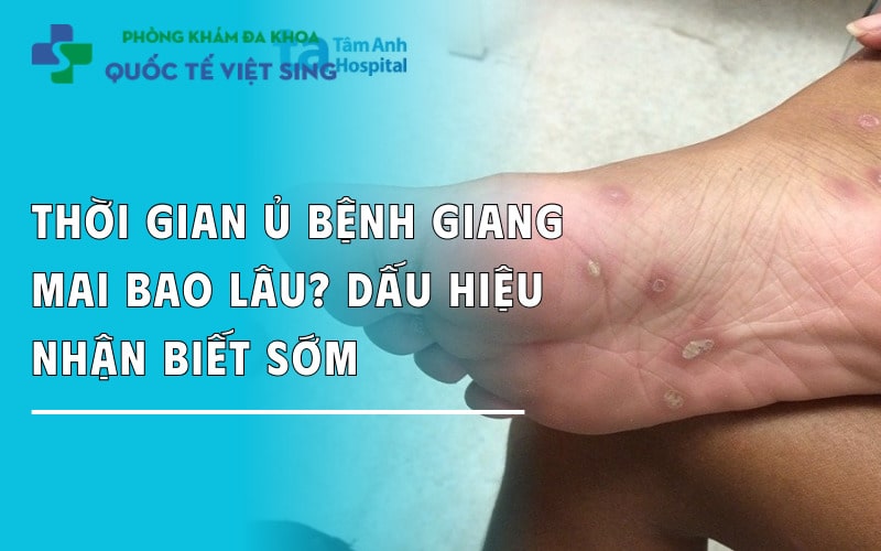 Thời gian ủ bệnh giang mai bao lâu? Dấu hiệu nhận biết sớm ở nam và nữ
