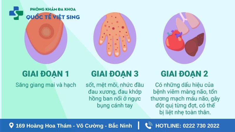 Giai đoạn chữa bệnh giang mai hợp lý nhất