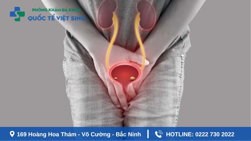 Dấu hiệu viêm niệu đạo nữ giới cần chú ý