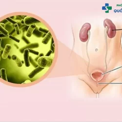 https://dakhoaquoctebacninh.com/wp-content/uploads/2023/10/thuoc-viem-bang-quang-1.jpg-250x250.webp