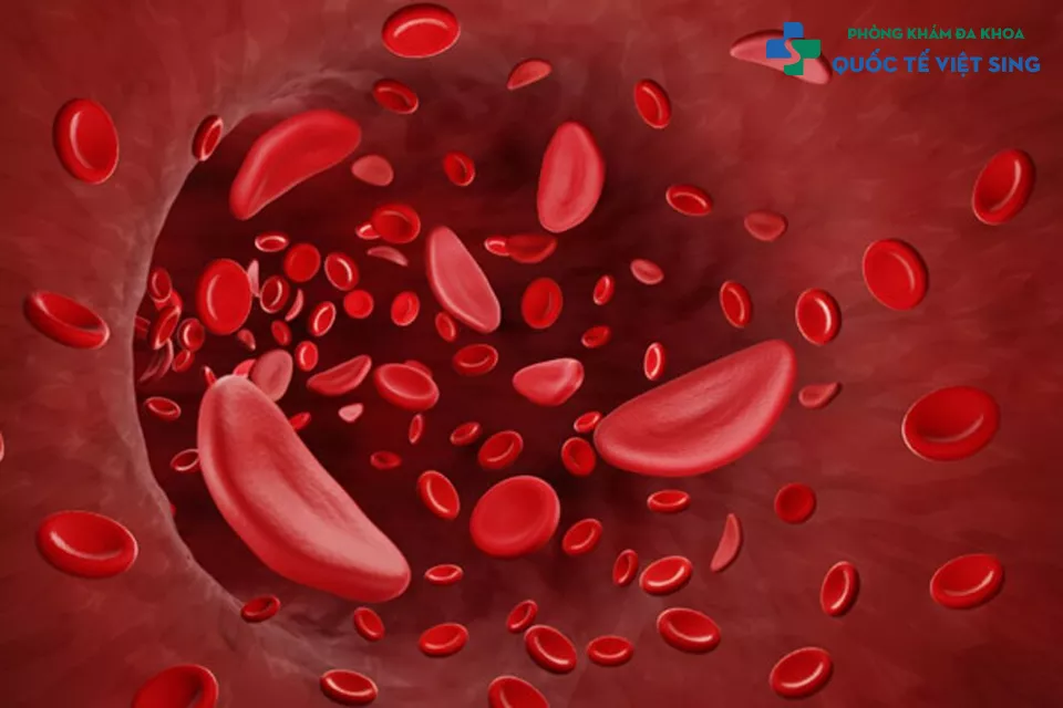 Các nguyên nhân phổ biến gây tiểu ra máu ở nam giới
