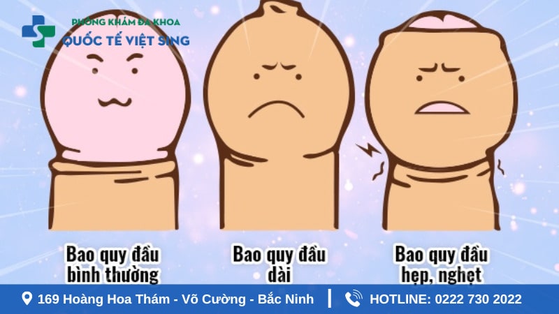 5 Lợi ích khi nam giới cắt bao quy đầu