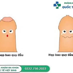 https://dakhoaquoctebacninh.com/wp-content/uploads/2024/05/bao-quy-dau-hep-1-250x250.webp