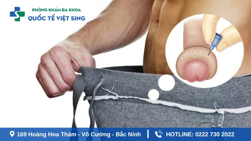 Bao quy đầu sưng mọng nước kèm theo triệu chứng khó chịu