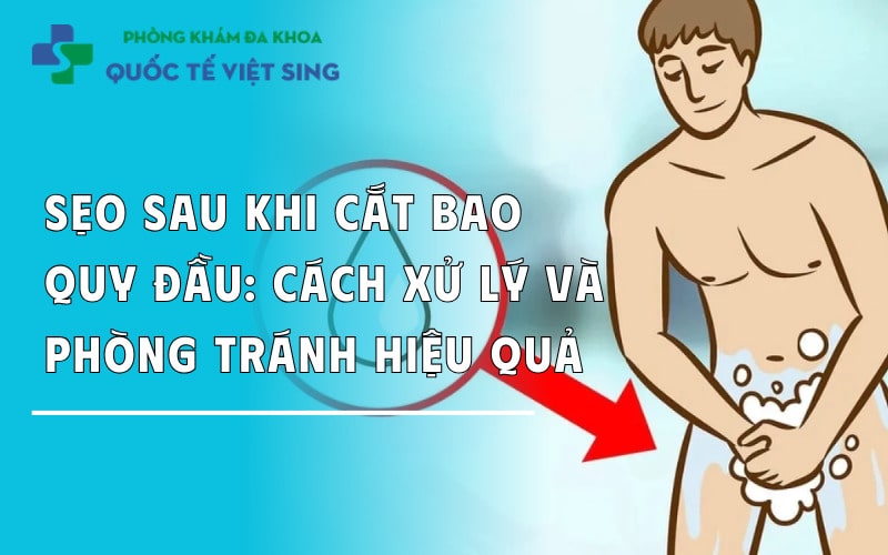 https://dakhoaquoctebacninh.com/wp-content/uploads/2024/05/bi-seo-sau-khi-cat-bao-quy-dau-cach-xy-ly-va-phong-tranh.jpg