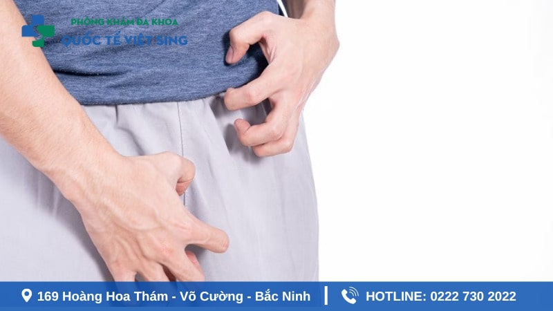 Biện pháp phòng tránh hình thành sẹo sau cắt bao quy đầu 