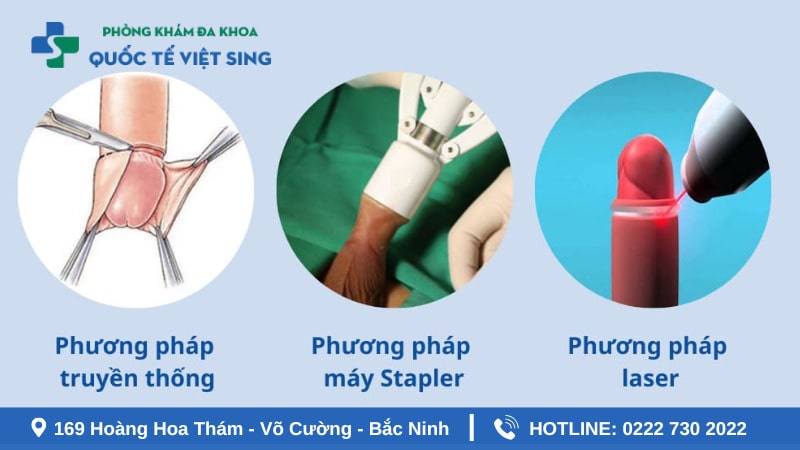 Cách khắc phục tình trạng bao quy đầu không thể tự lột