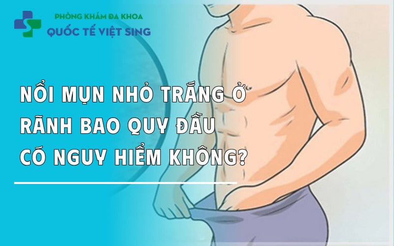 https://dakhoaquoctebacninh.com/wp-content/uploads/2024/05/nam-gioi-noi-mun-trang-ranh-bao-quy-dau-nguye-hiem-khong.jpg
