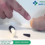 Nong bao quy đầu thực hiện khi nào? Cách nong an toàn là gì?