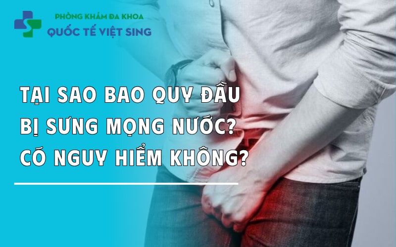 https://dakhoaquoctebacninh.com/wp-content/uploads/2024/05/tai-sao-bao-quy-dau-sung-mong-nuoc-co-nguy-hiem-khong.jpg