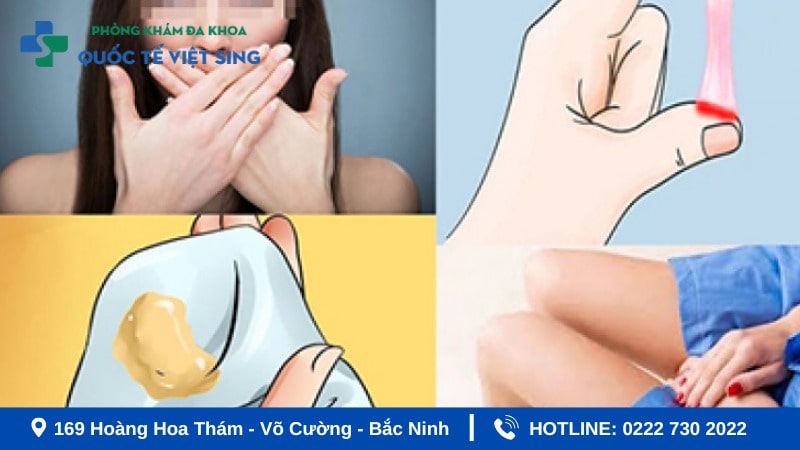 Chẩn đoán và điều trị khí hư bất thường