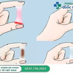 Nhận diện hình ảnh khí hư bất thường và bình thường 