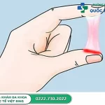 Khí hư có máu bất thường – Dấu hiệu bất thường chị em không nên chủ quan