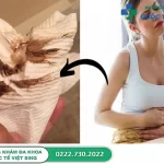 [Hỏi – Đáp] Khí hư màu nâu có máu có phải bệnh nguy hiểm không?