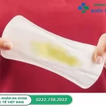 Khí hư màu vàng – Dấu hiệu bất thường ở vùng kín không nên bỏ qua