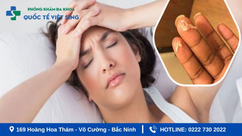 Tình trạng khí hư ra nhiều có sao không?