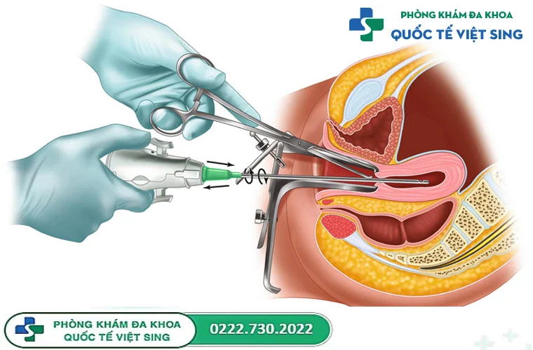 Cách phá thai 1 tháng tuổi nào an toàn và hiệu quả nhất