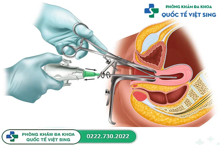 Các phương pháp phá thai an toàn hiện nay