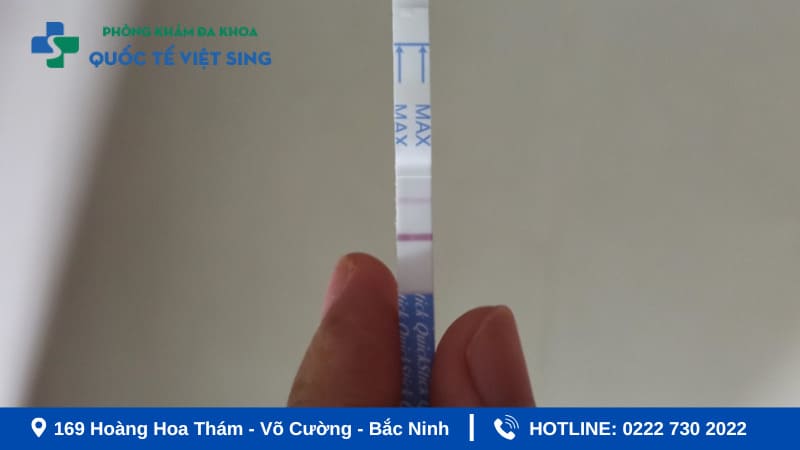 Nguyên nhân <yoastmark class=