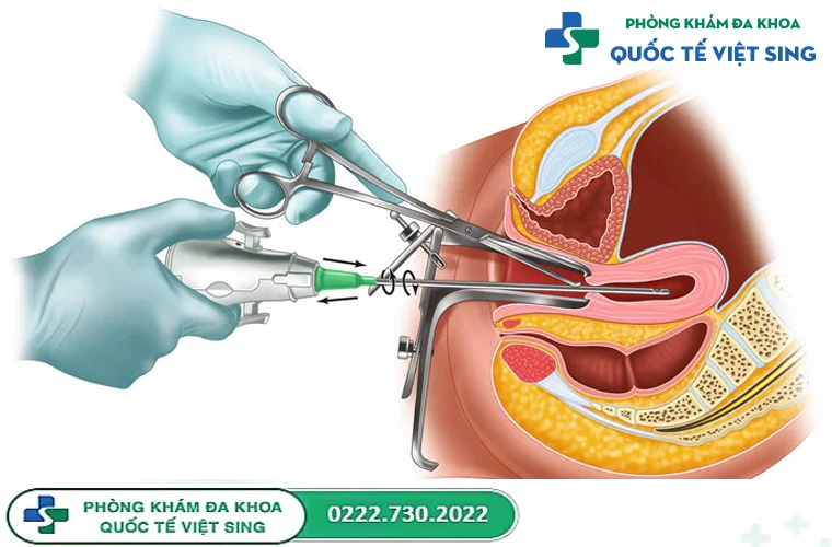 Một số phương pháp phá thai an toàn và phổ biến hiện nay