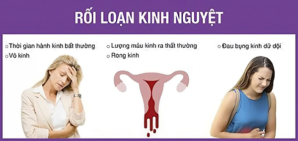 Rối loạn kinh nguyệt là như thế nào? 