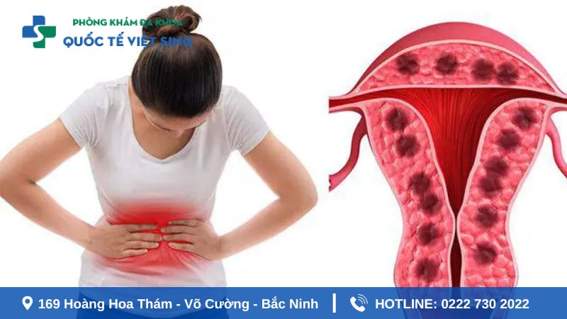 Phòng ngừa và điều trị rối loạn kinh nguyệt hiệu quả