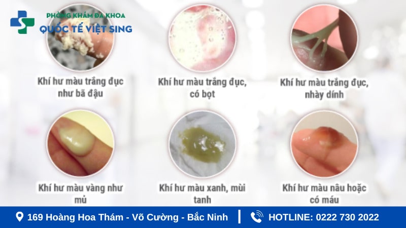 Khí hư bất thường dấu hệu bệnh lý