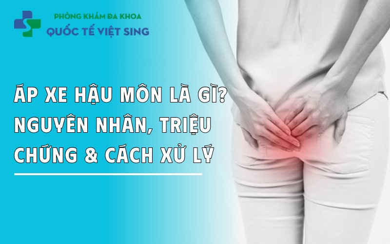 https://dakhoaquoctebacninh.com/wp-content/uploads/2025/05/ap-xe-hau-mon-la-gi-nguyen-nhan-cach-dieu-tri.jpg