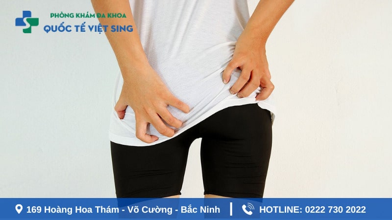 Áp xe hậu môn là tình trạng gì ?