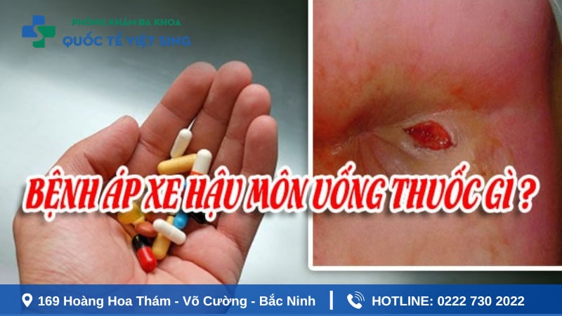 Áp xe hậu môn uống thuốc gì an toàn và hiệu quả