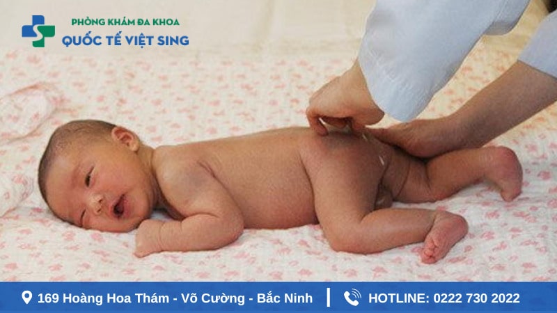 Cách điều trị áp xe hậu môn trẻ sơ sinh an toàn