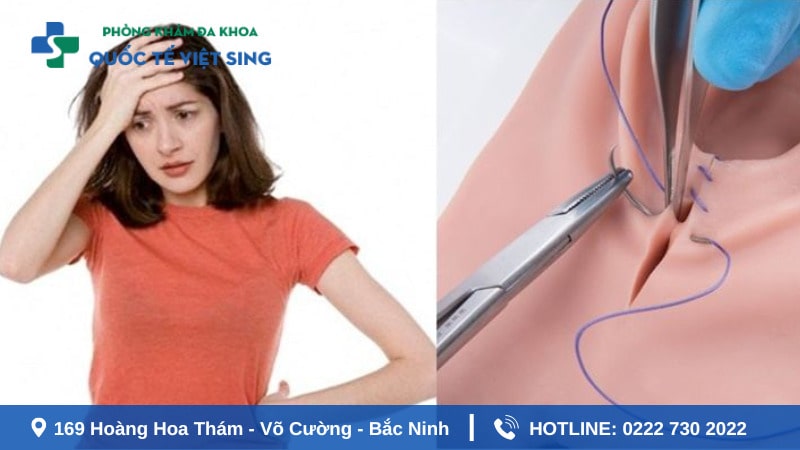 Có nên thu hẹp tầng sinh môn sau sinh không?