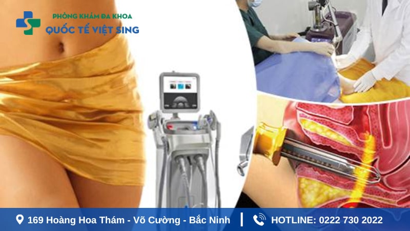 Có nên thu hẹp vùng kín bằng Laser hay không ?