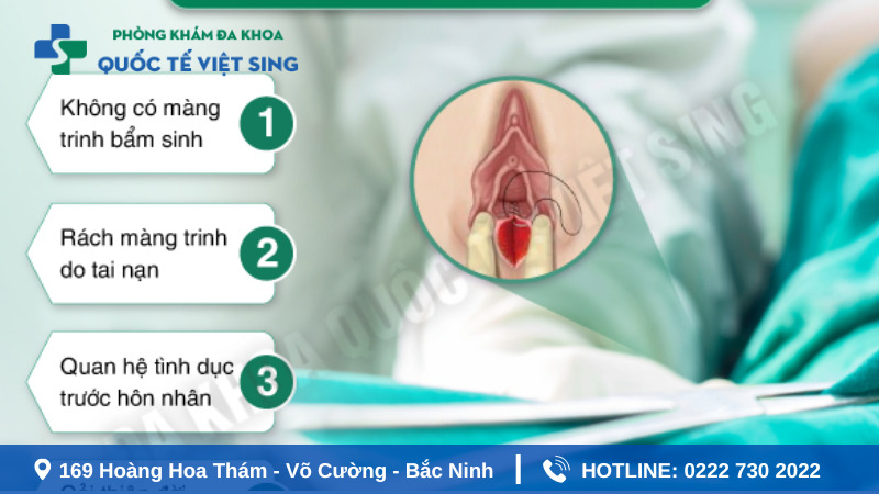 Chi phí vá màng trinh hết bao nhiêu tiền? - Cập nhật bảng giá 2025