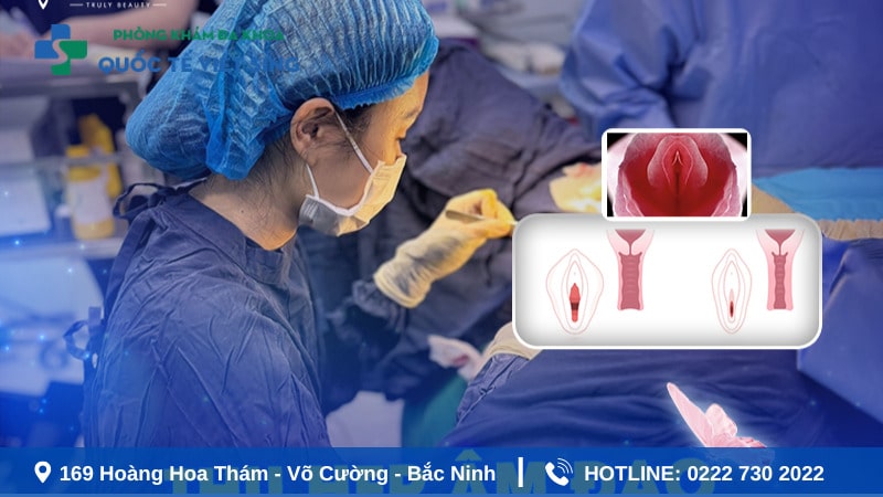 Thu hẹp vùng kín là gì?