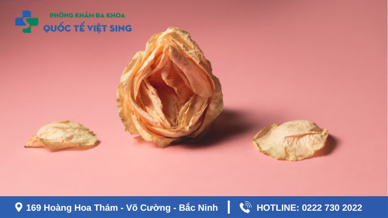Tầng sinh môn là gì?