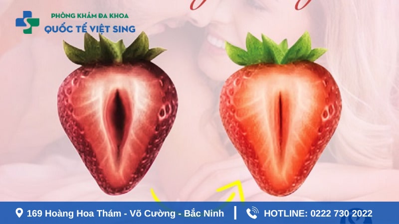 Đối tượng nào nên thu hẹp tầng sinh môn?