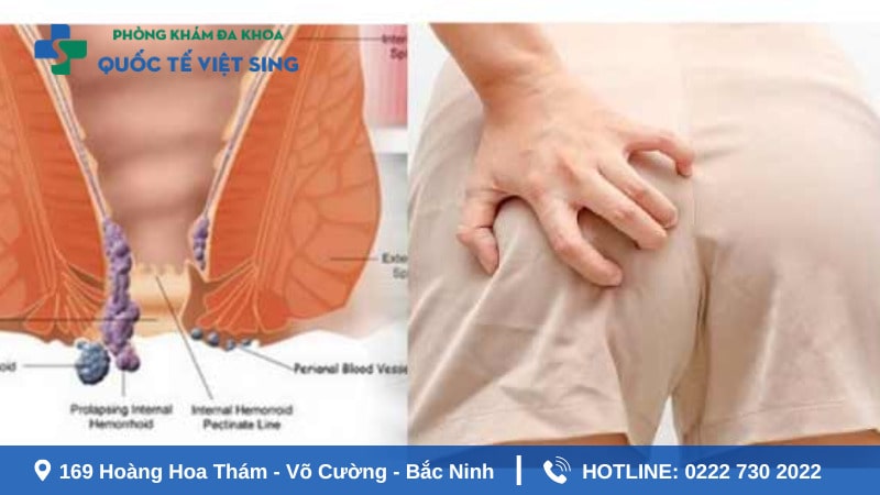 Khám ngứa hậu môn gồm những gì?