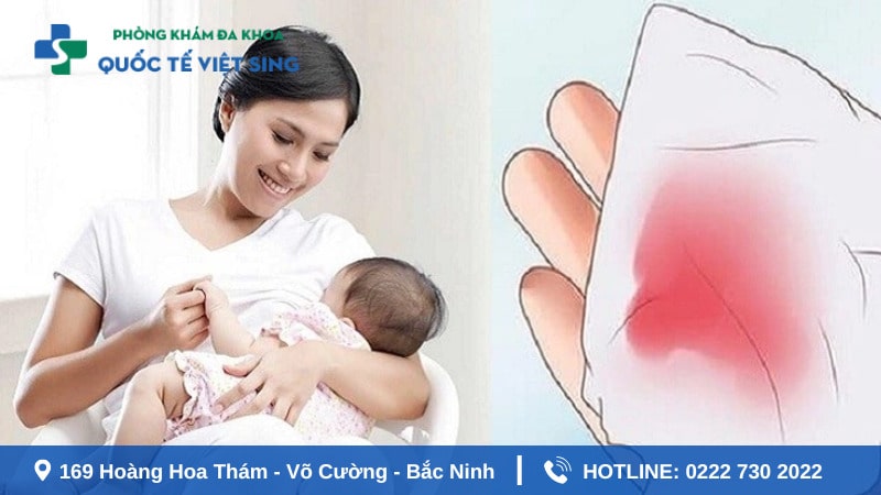 Cần đi khám khi thành trạng kinh nguyệt không đều sau sinh kéo dài
