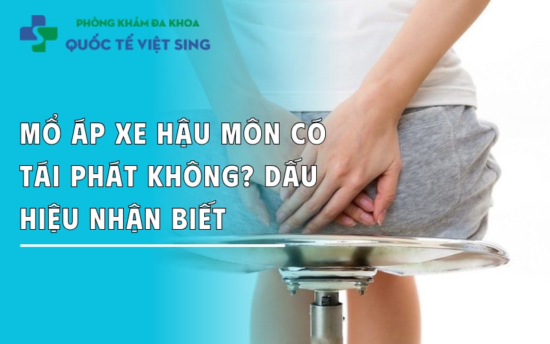 https://dakhoaquoctebacninh.com/wp-content/uploads/2025/05/mo-ap-xe-hau-mon-co-bi-tai-phat-khong.jpg