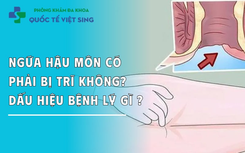 https://dakhoaquoctebacninh.com/wp-content/uploads/2025/05/ngua-hau-mon-co-phai-bi-tri-khong-dau-hieu-benh-ly-gi.jpg