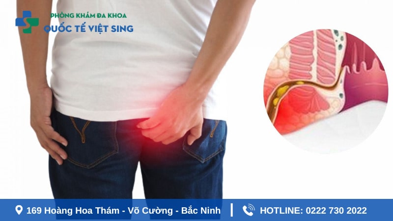 Vậy ngứa hậu môn là dấu hiệu của bệnh lý gì?