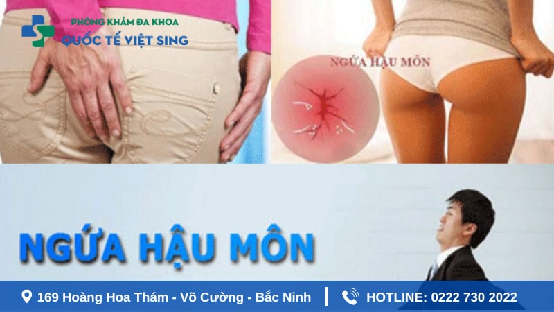 Bị ngứa hậu môn sau khi đi vệ sinh có nguy hiểm không?