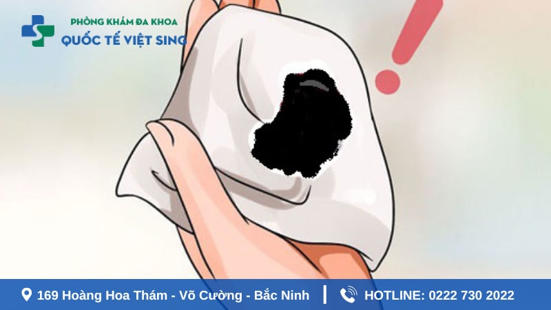 Nguyên nhân do rối loạn nội tiết tố