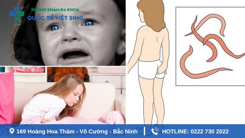 Nguyên nhân khiến trẻ bị giun kim ngứa hậu môn