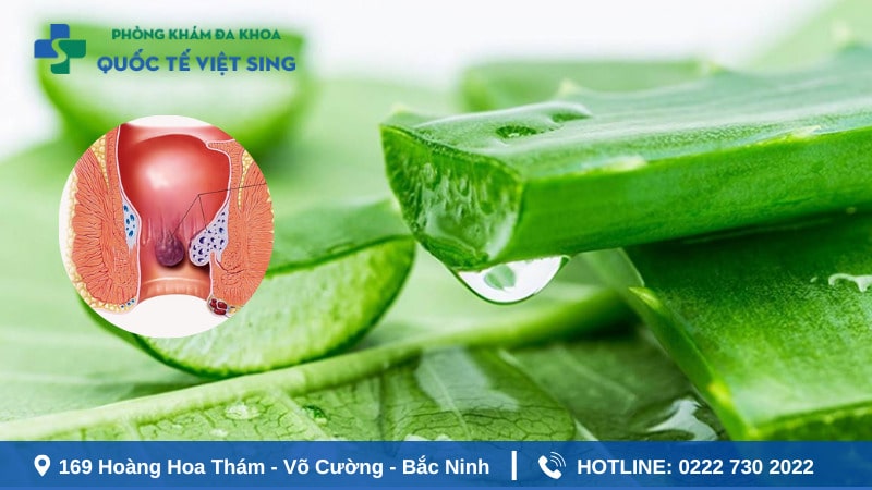 Sử dụng nha đam để giảm ngứa hậu môn sau mổ trĩ