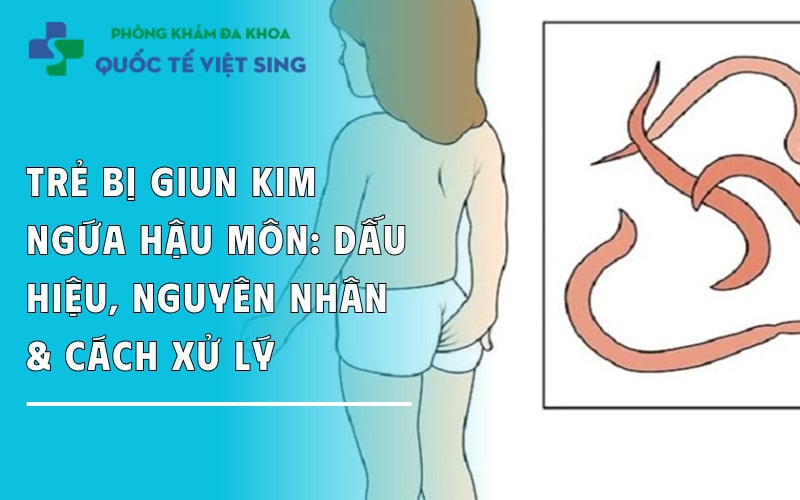 https://dakhoaquoctebacninh.com/wp-content/uploads/2025/05/tre-bi-run-kim-ngua-hau-mon-dau-hieu-va-cach-xu-ly.jpg