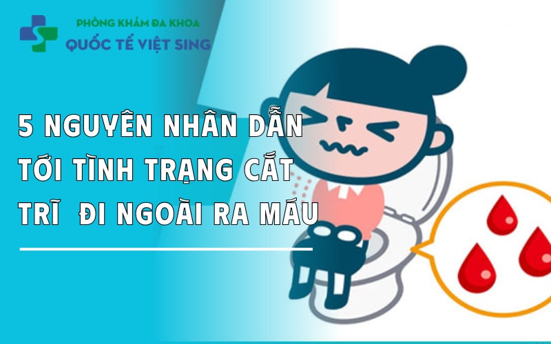 https://dakhoaquoctebacninh.com/wp-content/uploads/2025/06/5-nguyen-nhan-cat-tri-xong-di-ngoai-ra-mau.jpg