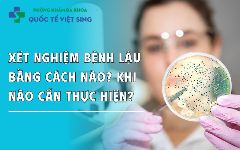 Xét nghiệm bệnh lậu bằng cách nào? Khi nào cần thực hiện?